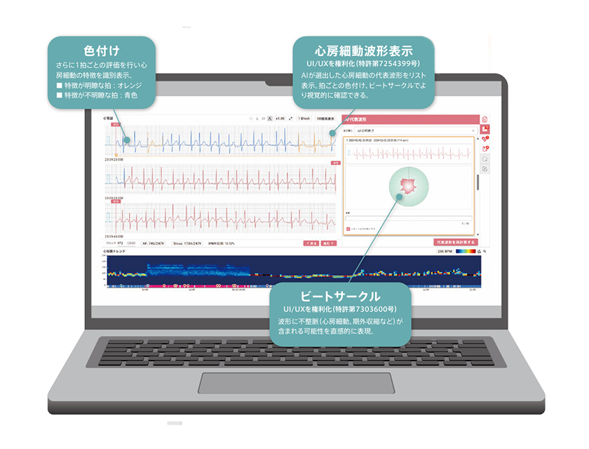 特集2　株式会社カルディオインテリジェンス