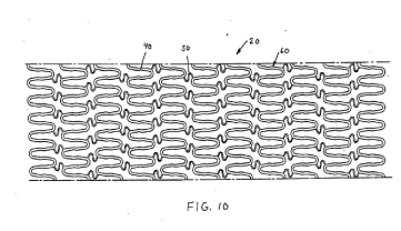 A61F0002915000_0